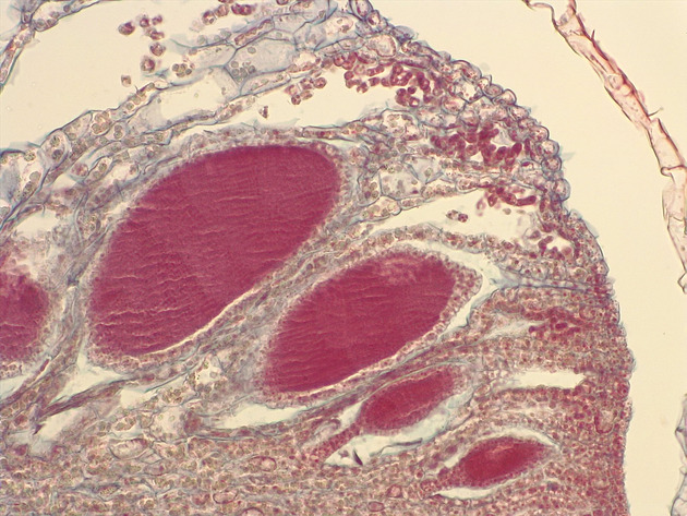 Liverwort Antheridia CS Slides - Liverwort Antheridia CS 01 200X